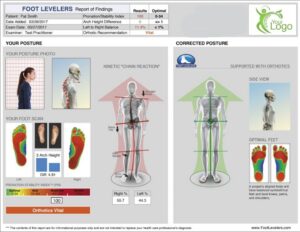 Straightened out spine!