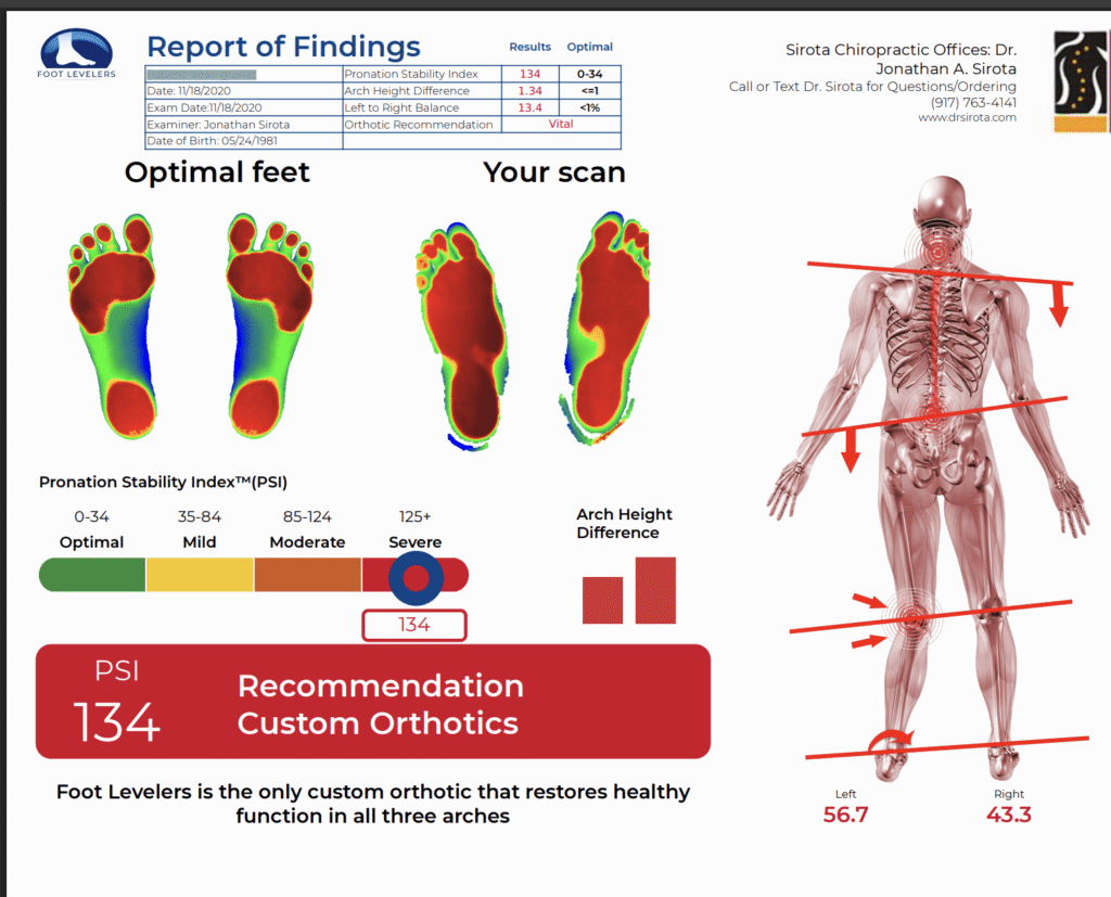 5 years ago, BEFORE wearing Orthotics by Footlevelers 2020